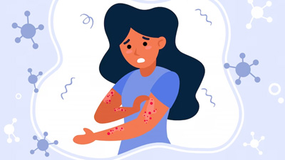 Recognising the Red Flags: 20 Signs You Have an Autoimmune Disease