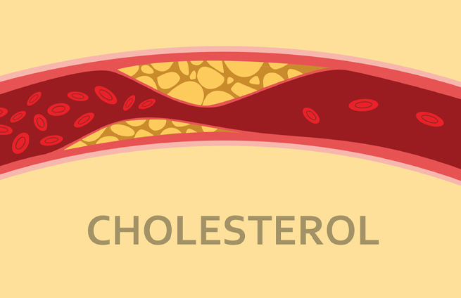 How To Improve Ldl And Hdl Cholesterol