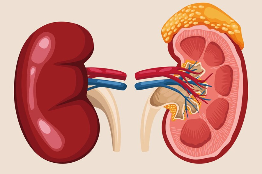 diabetic-kidney-disease
