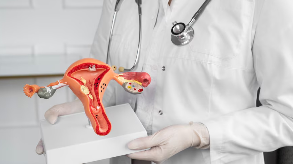 cervical cancer