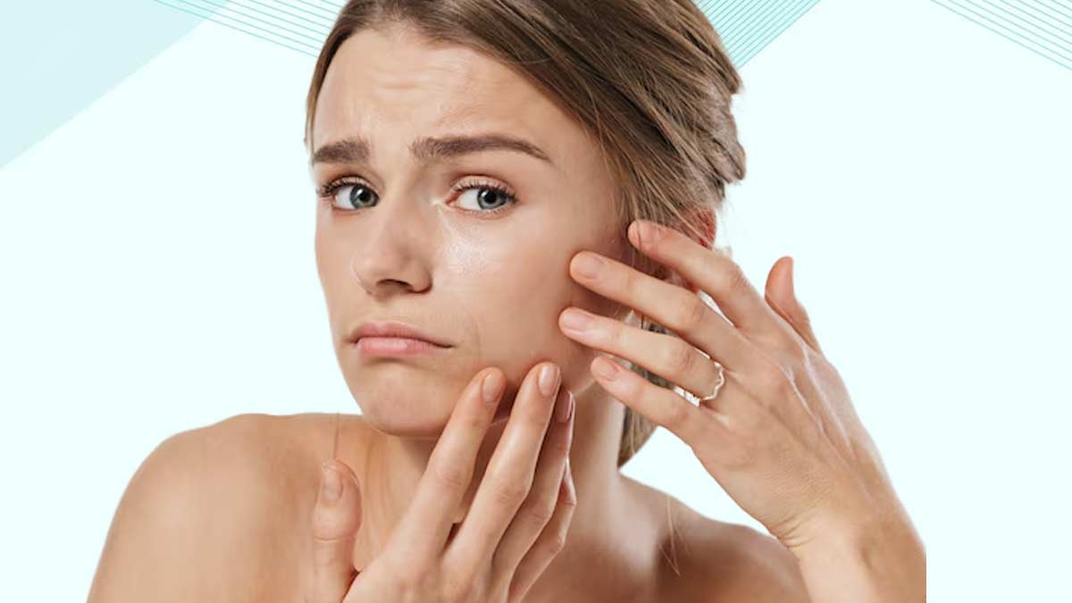 dry skin causes