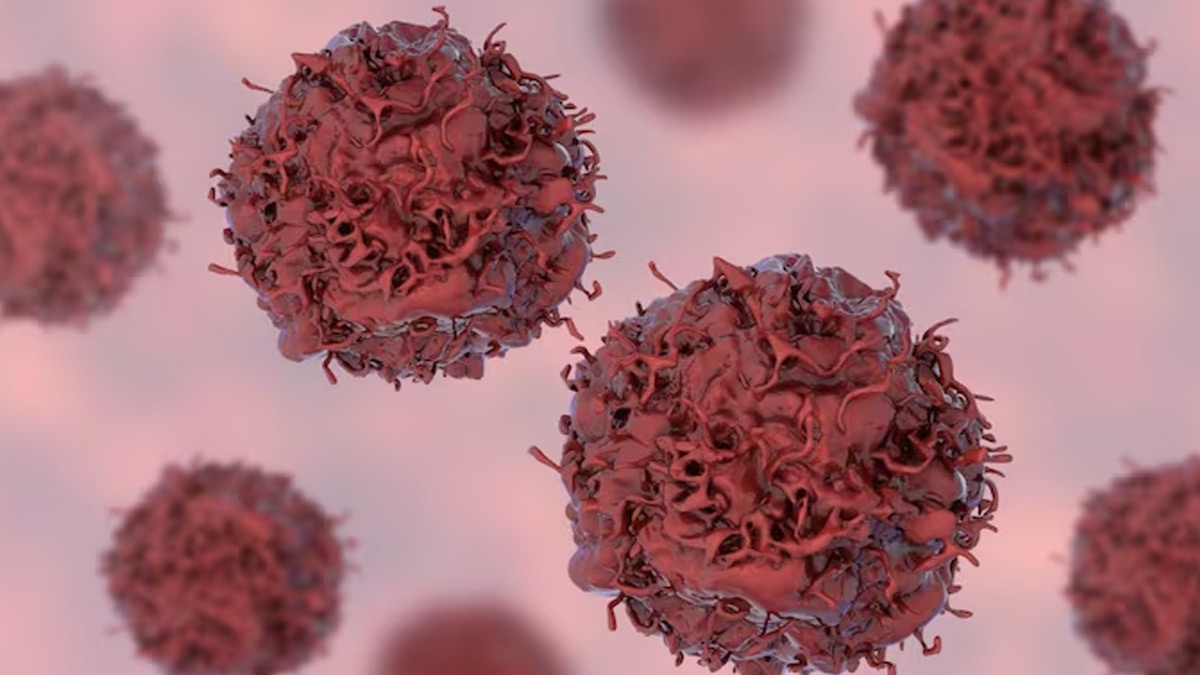 Car T Cell Therapy