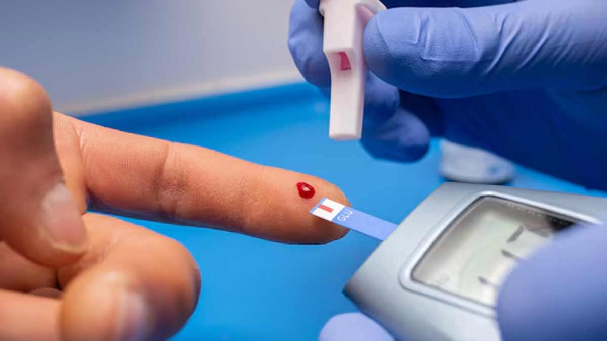 OGCT test in pregnancy