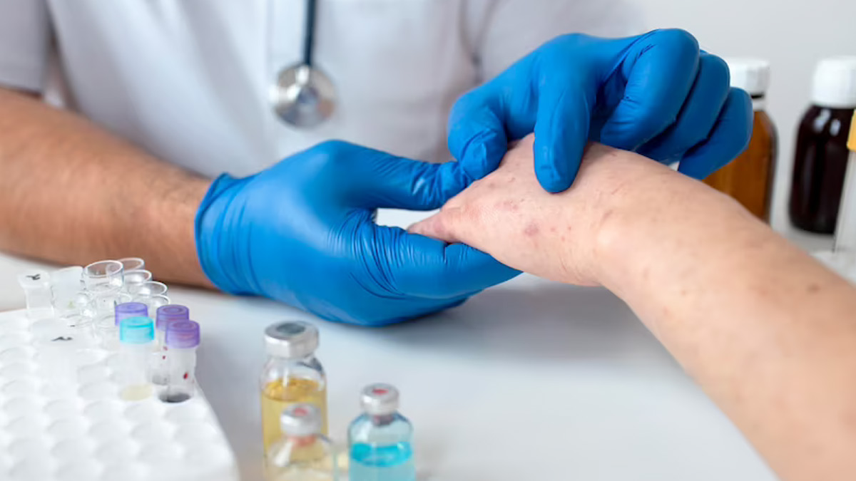 Sun Safety Tips for Every Season to Protect Against Skin Cancer