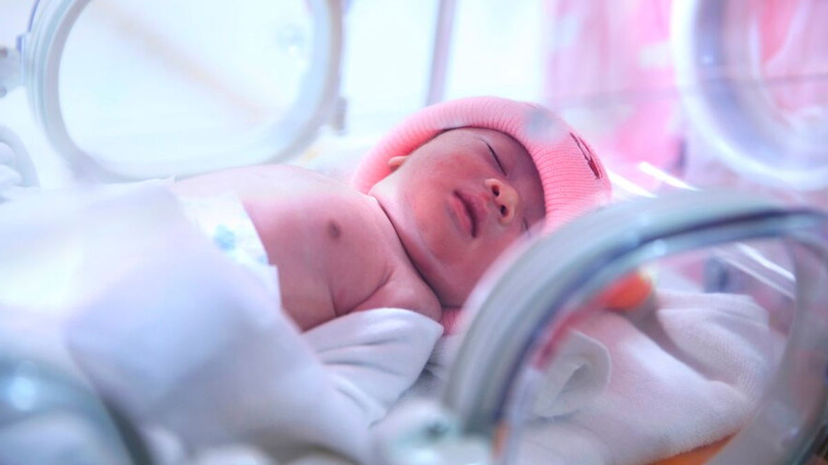 True Story Of A Baby Born Without Anal Opening: Doctors Explain This Rare Case Of Anorectal Malformation