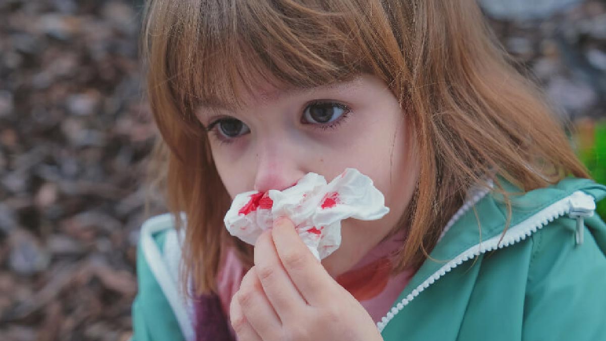 nose bleeding in hindi