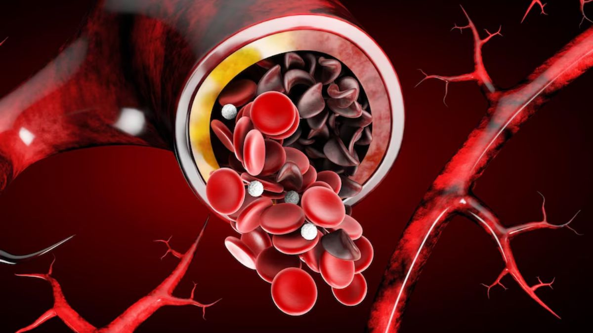 Dates Benefits in High Cholesterol