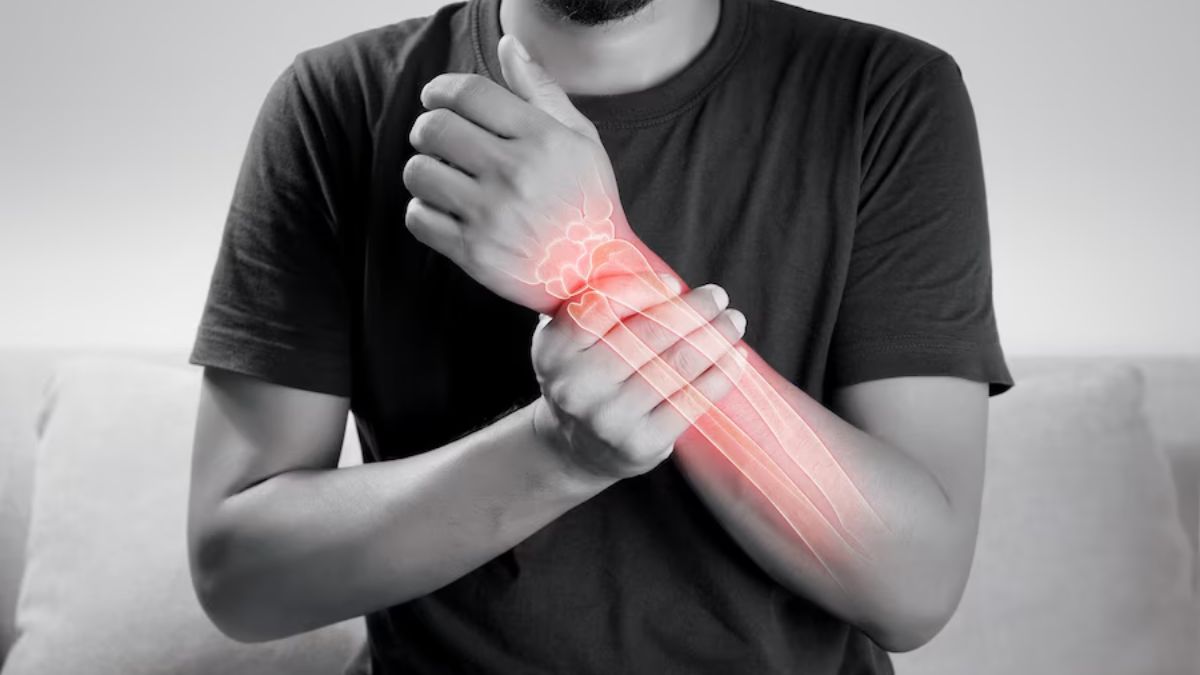 Weather Change And Arthritis