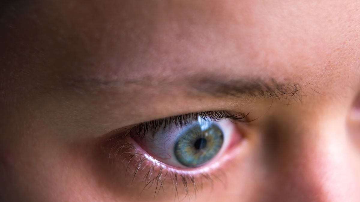 Graves Disease