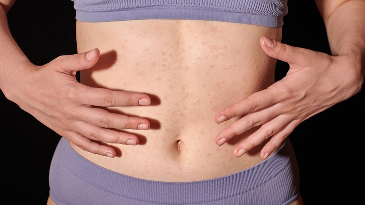 belly-button-discharge