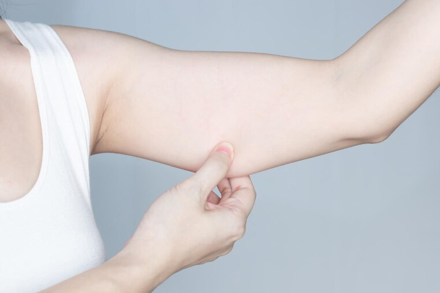 Arm fat