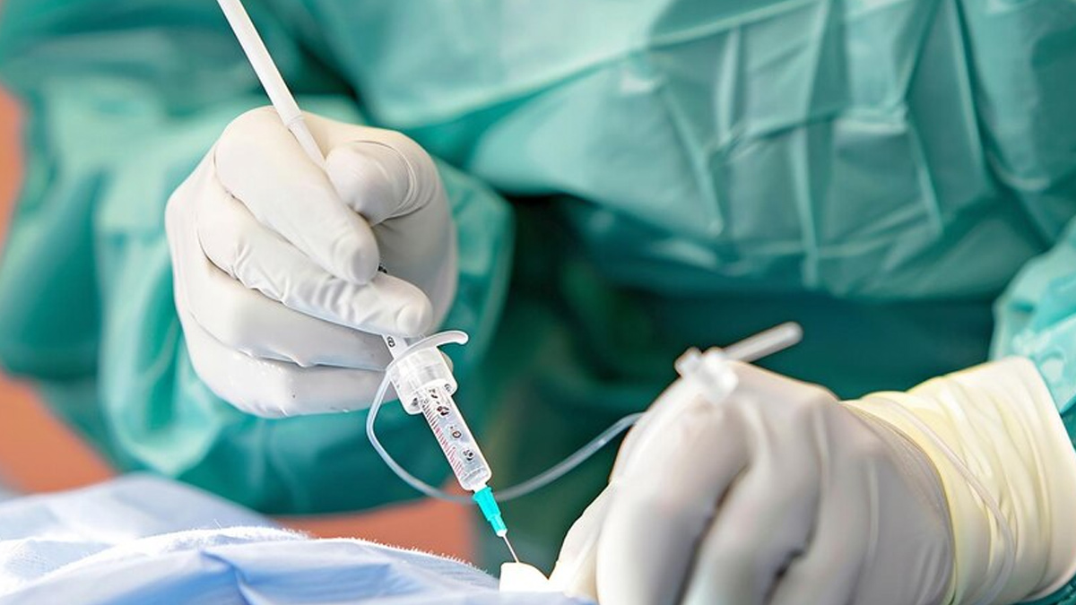 Regional-anaesthesia