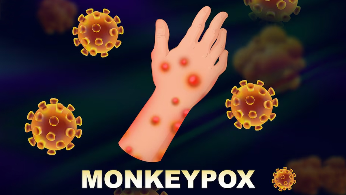 mpox
