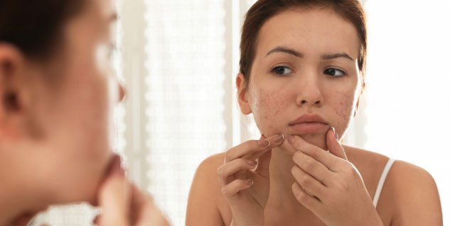 Expert explains link between stress and skin conditions