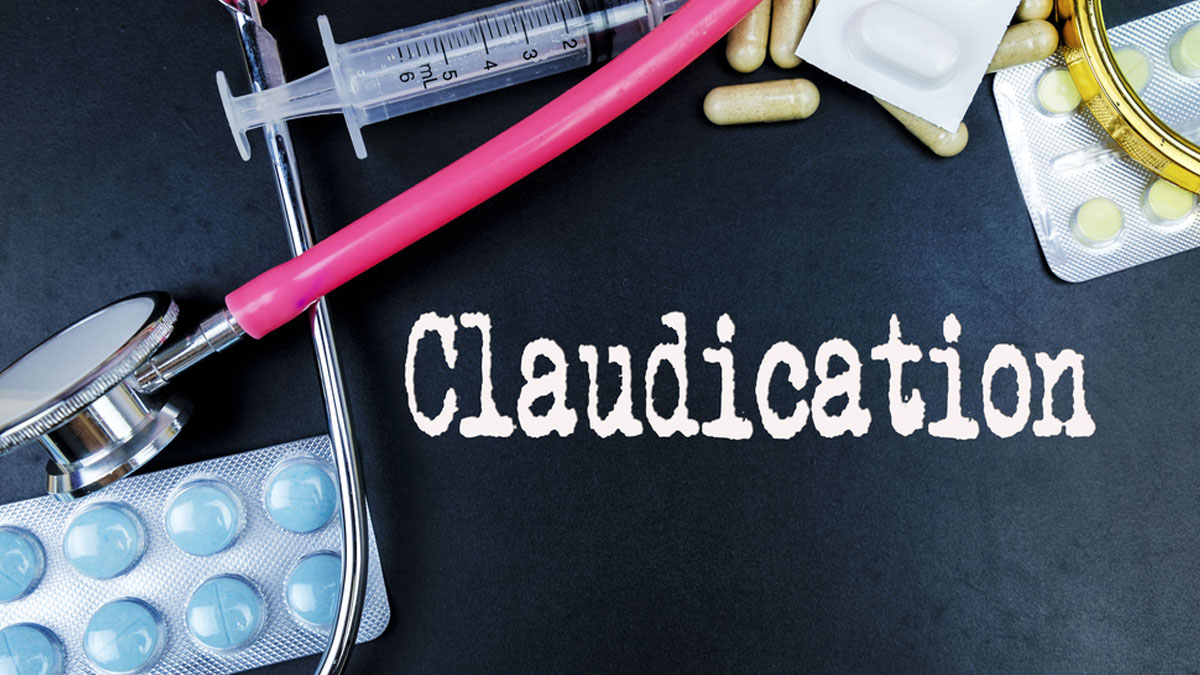 claudication