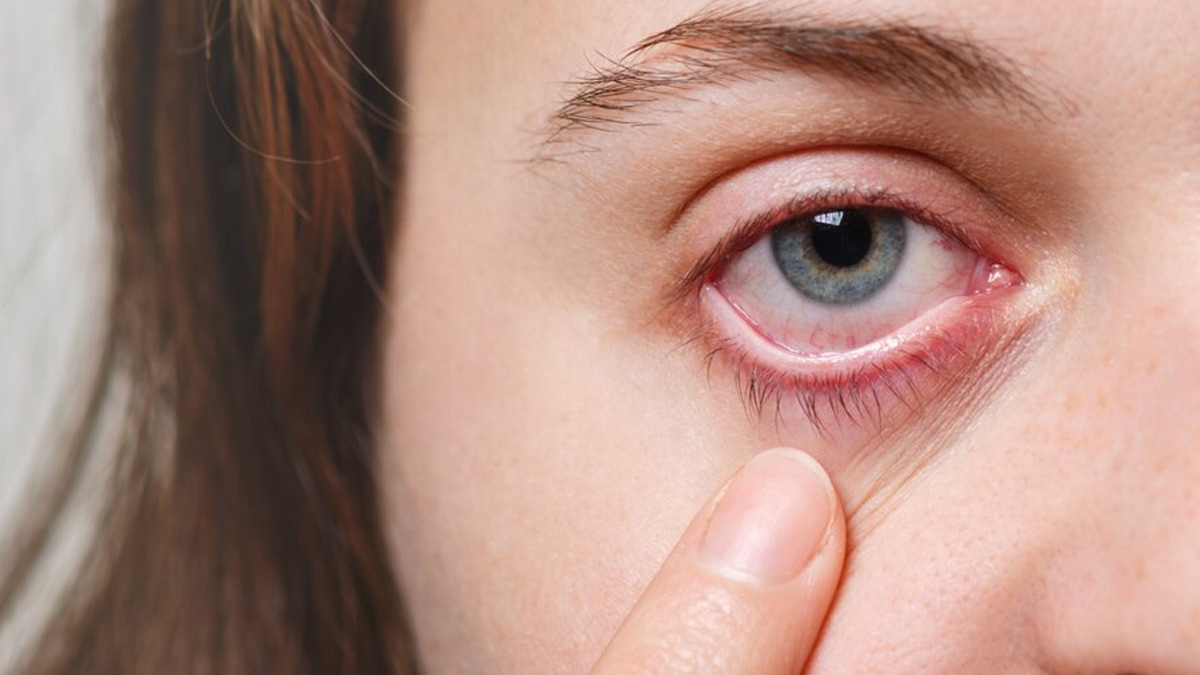 Here Are Some Eye Complications During Winter And Tips To Prevent It