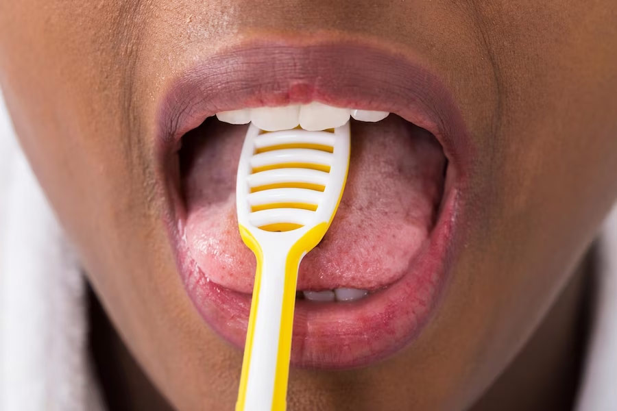 tongue scrapping benefits
