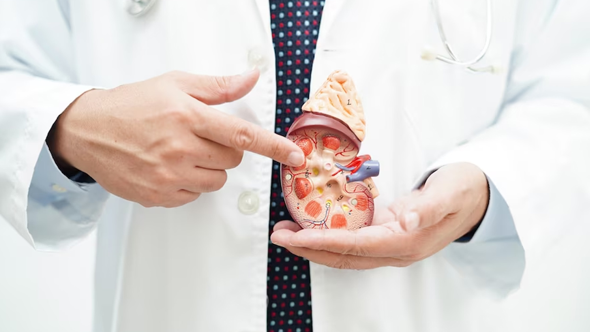 Home Remedies to Naturally Lower Creatinine Levels