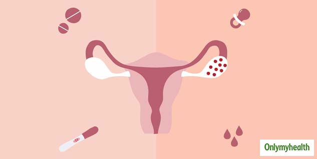 Lifestyle Strategies for Managing PCOS Symptoms