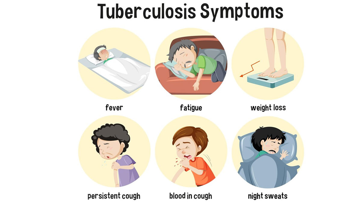 Abdominal Tuberculosis Symptoms in Hindi