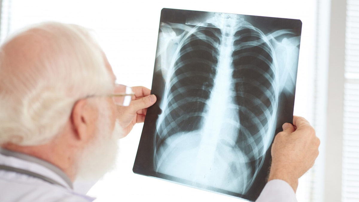 Can Abdominal TB Come Back After Treatment In Hindi