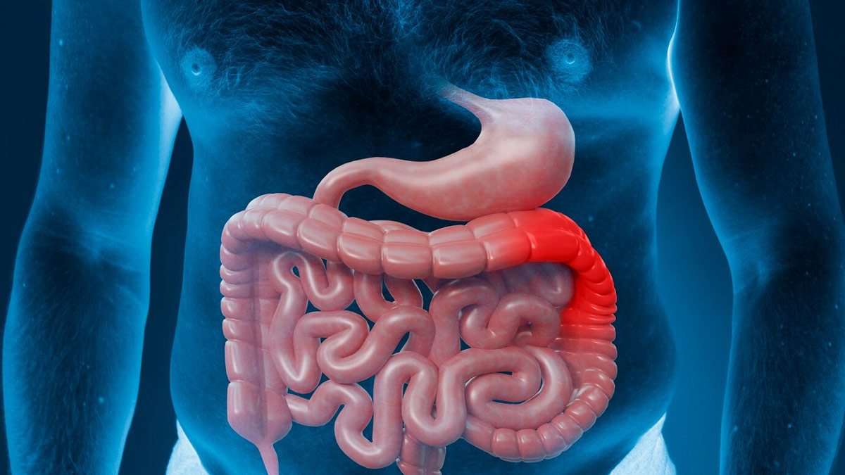 Pancreatic Cancer Causes Symptoms