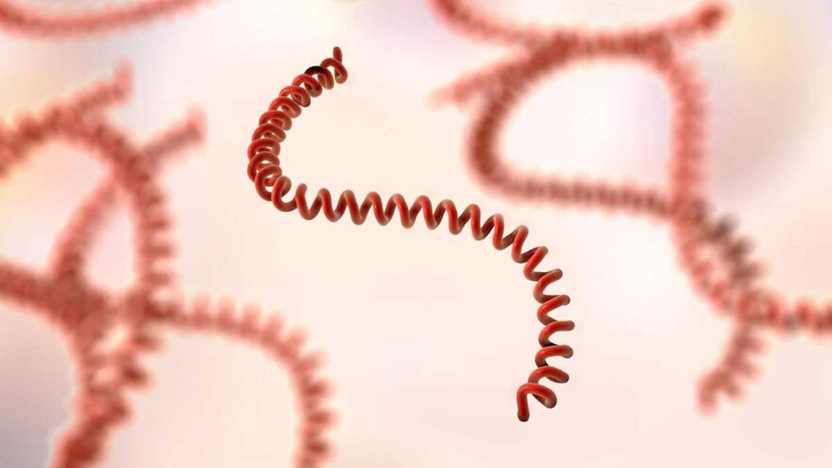 what is leptospirosis and its preventive measures