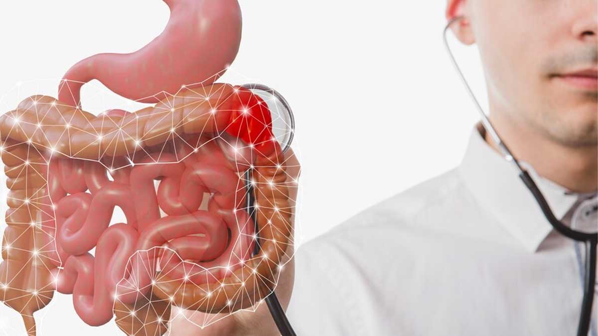 Colorectal Cancer