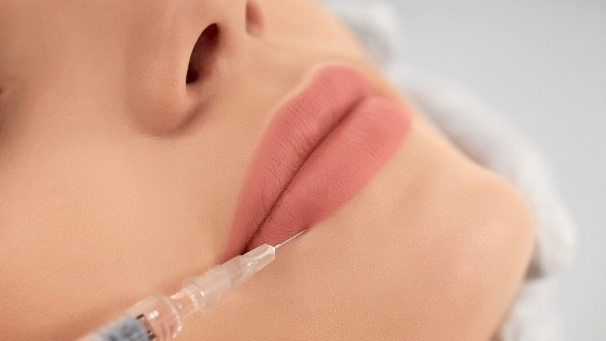 Shobhita Dhulipala's Old Photos Confirm Lip Fillers, Things To Consider Before Injecting Fillers