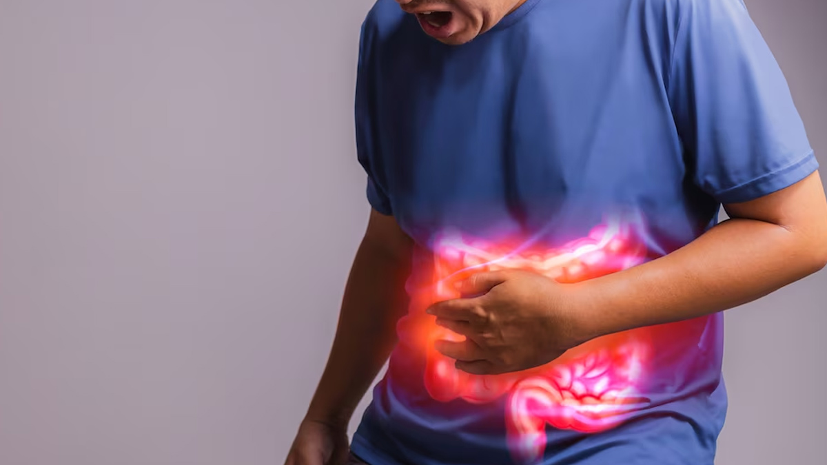 inflammatory-bowel-disease