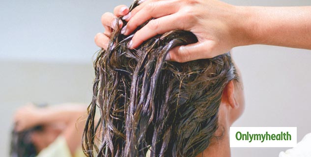 Tips to Treat Extreme Dry Hair and Dandruff in Winter