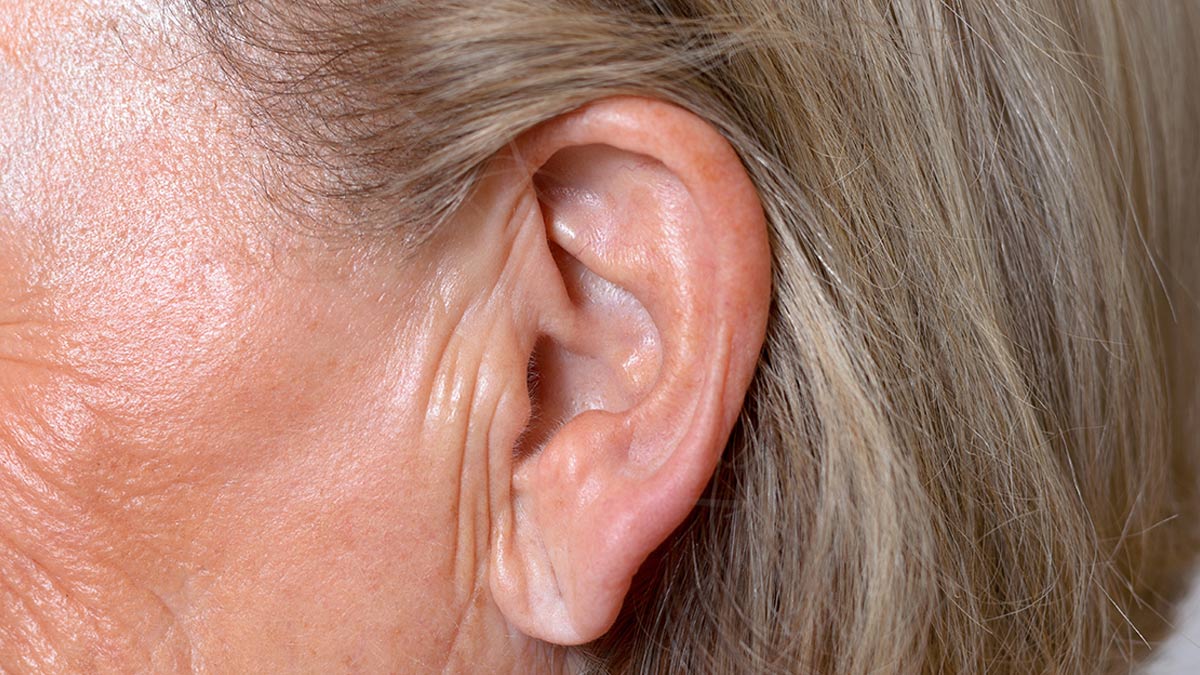 Ear Lobe Crease And Heart Attack