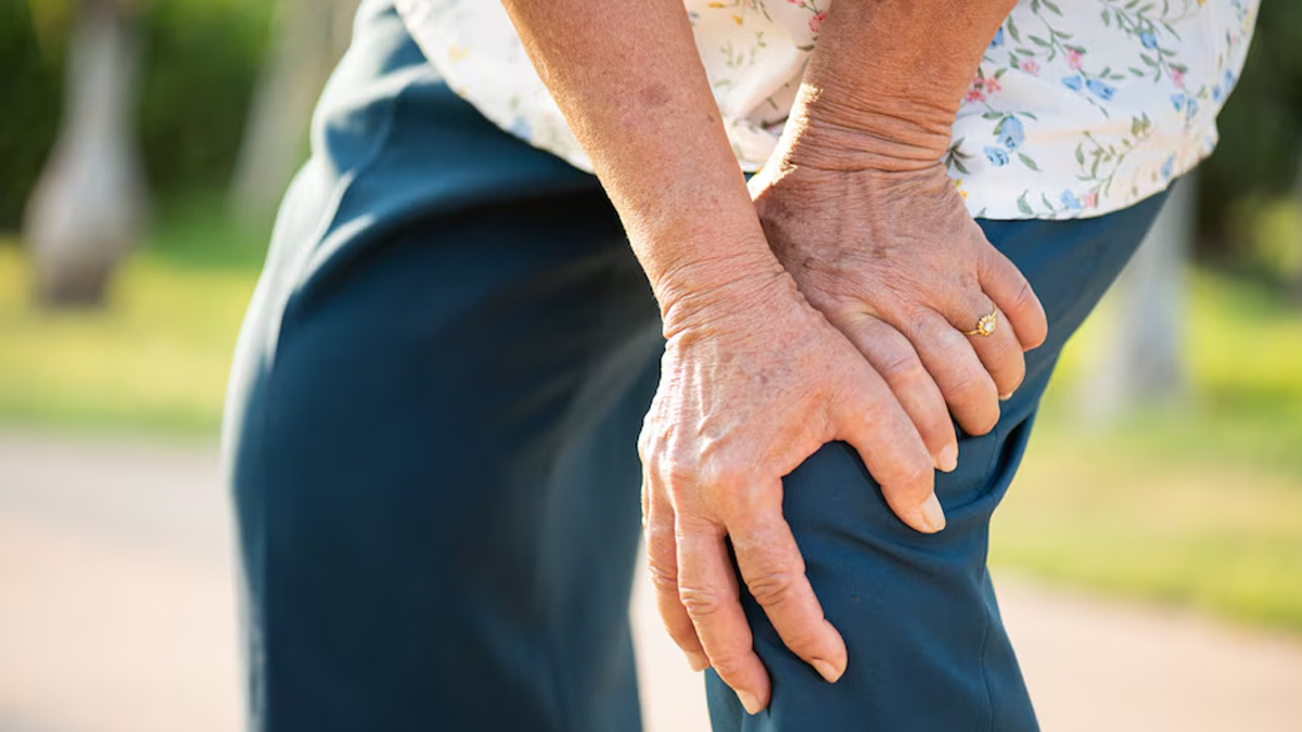 Scleroderma Explained: Causes, Symptoms, Diagnosis, Management