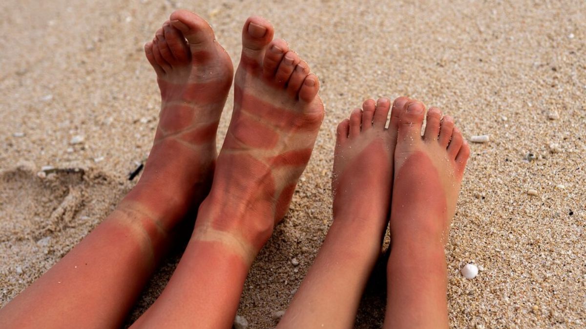 Exfoliation Can Help You Reduce Sun Tan