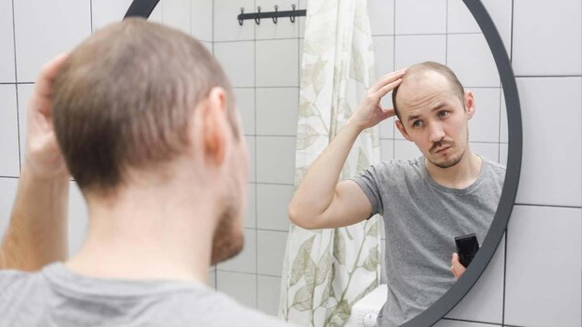 alopeia vs hairfall