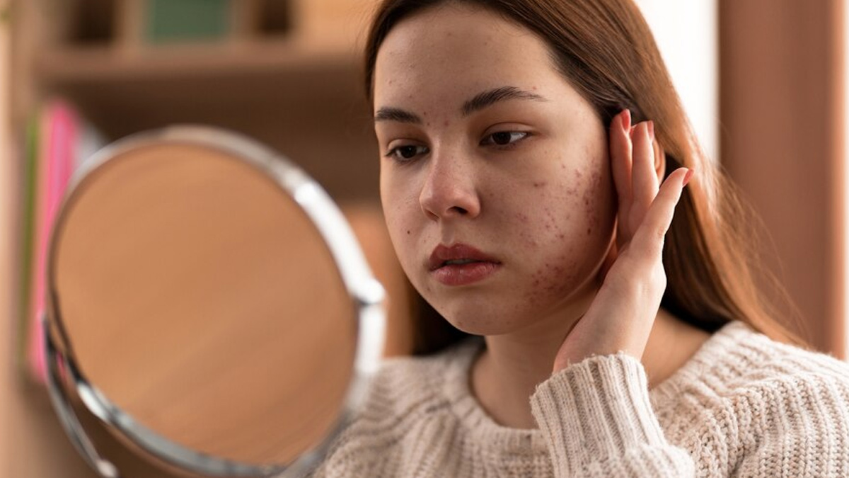 sugar scrubs side effects