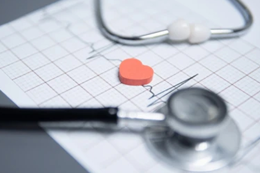 Normal-Sinus-Arrhythmia