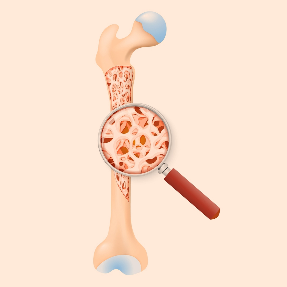 bone-density