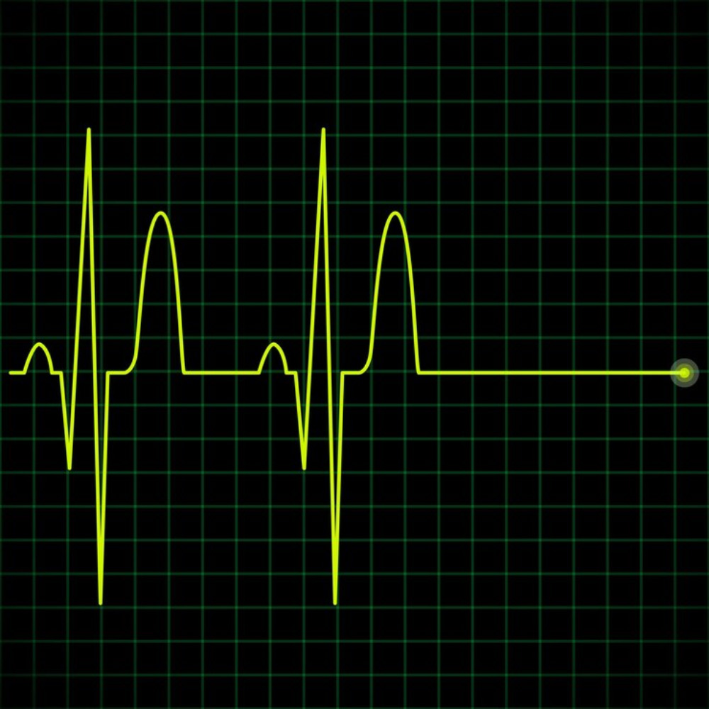 heart beat