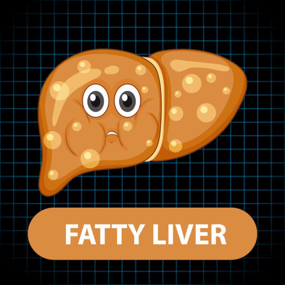 fatty liver