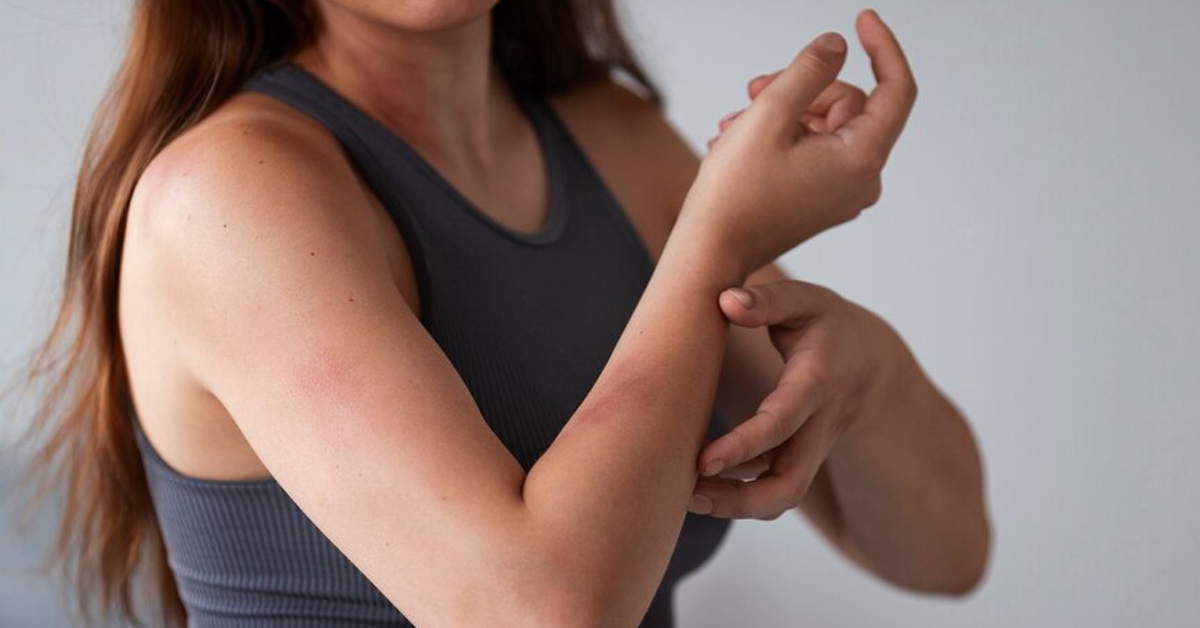 Early Symptoms of Chickenpox