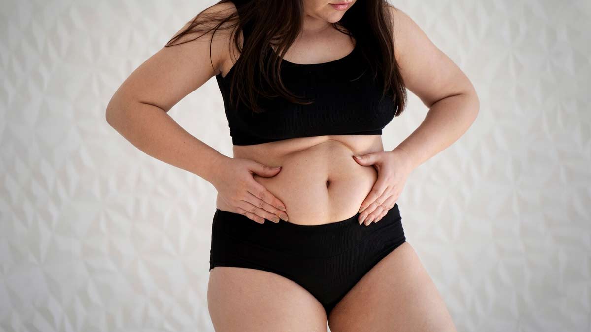 belly fat
