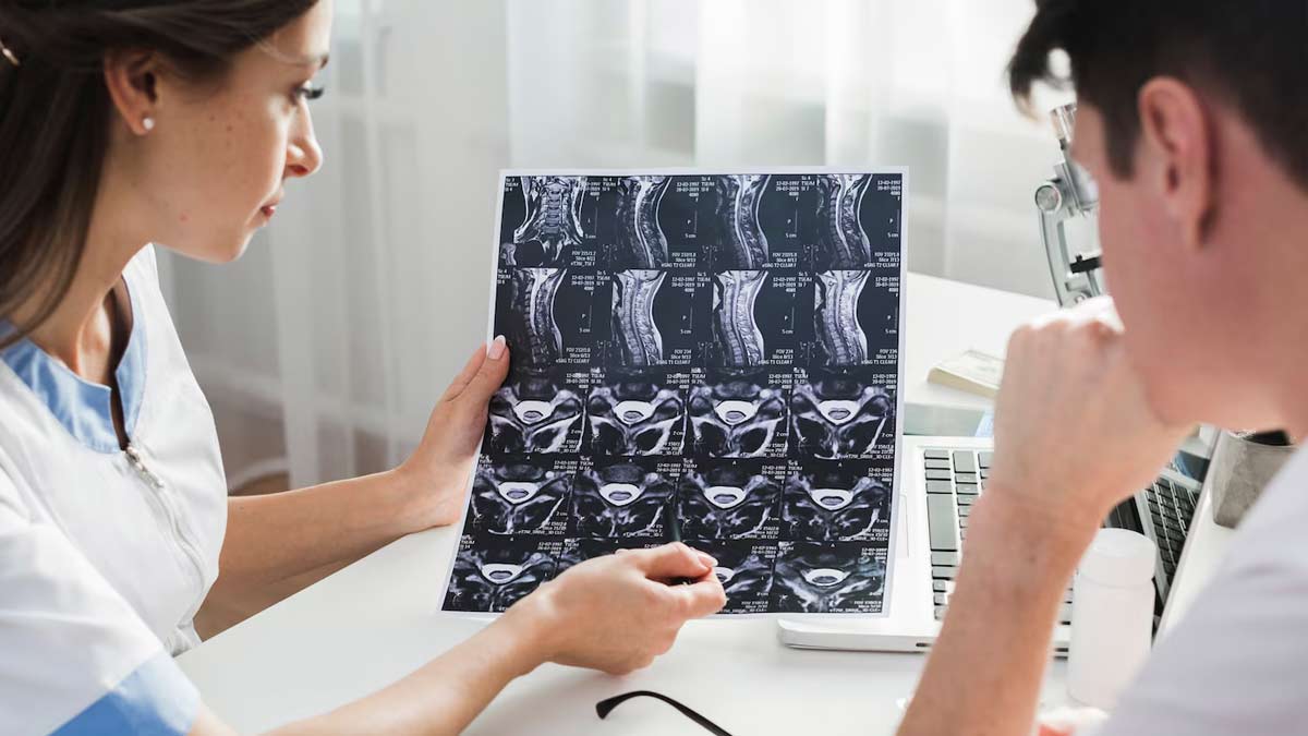 myths about brain tumor