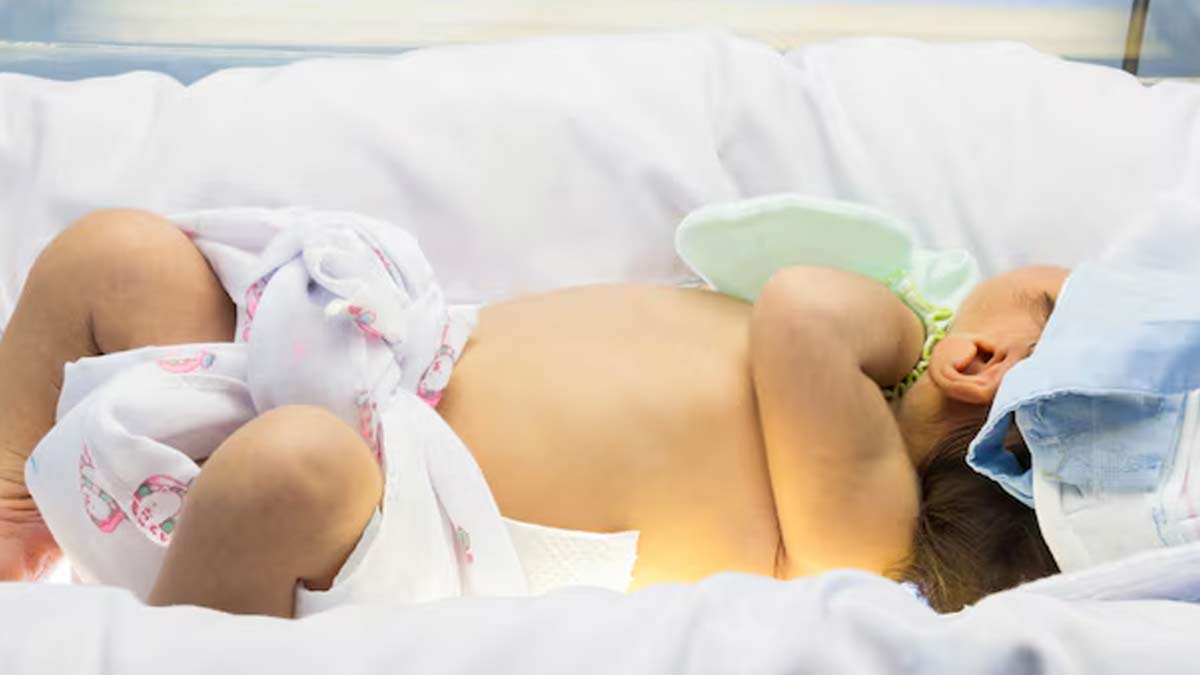 What Is Phototherapy And How Is It Useful In Jaundice In Hindi