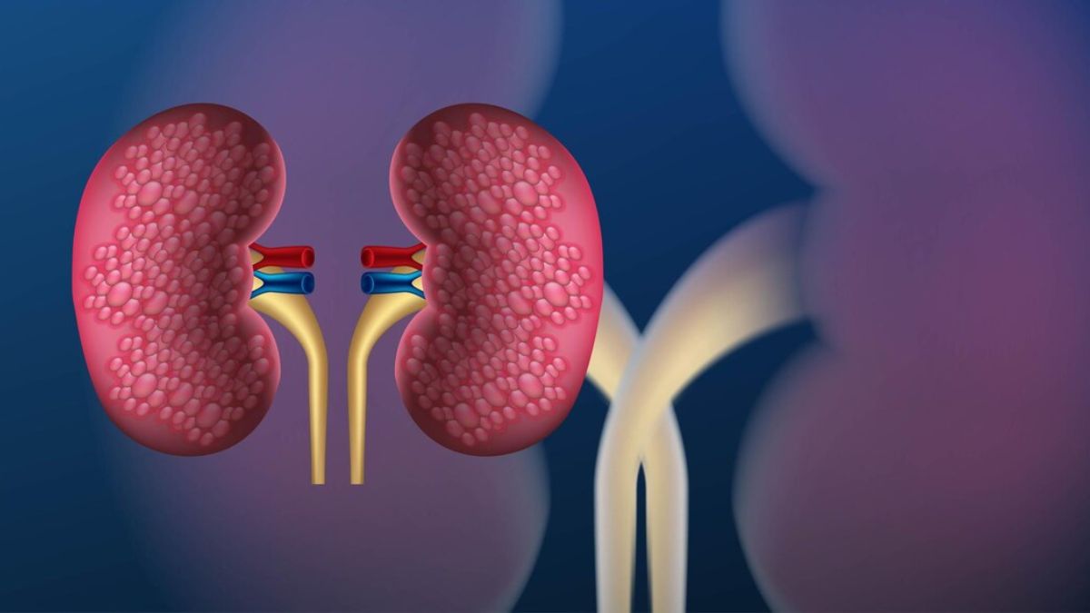 How Does Kidney Disease Cause Anaemia? Tips To Restore Haemoglobin Level