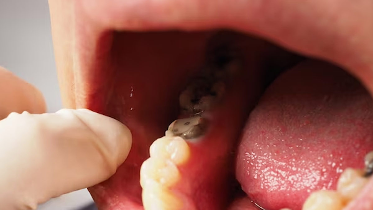 oral cavity prevention tips