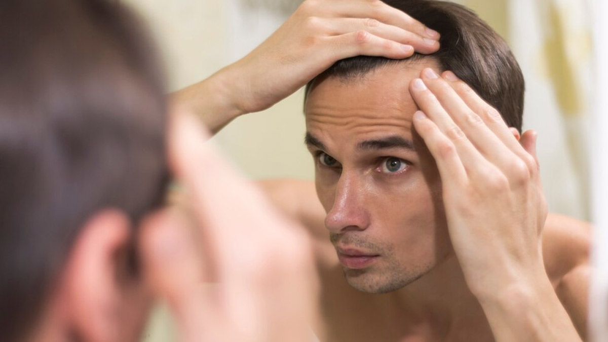 Hair Loss Woes Common Reasons Why Men Under Experience Baldness And