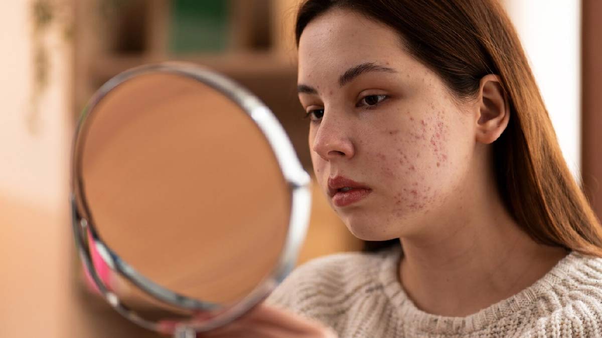 overactive thyroid and skin issues