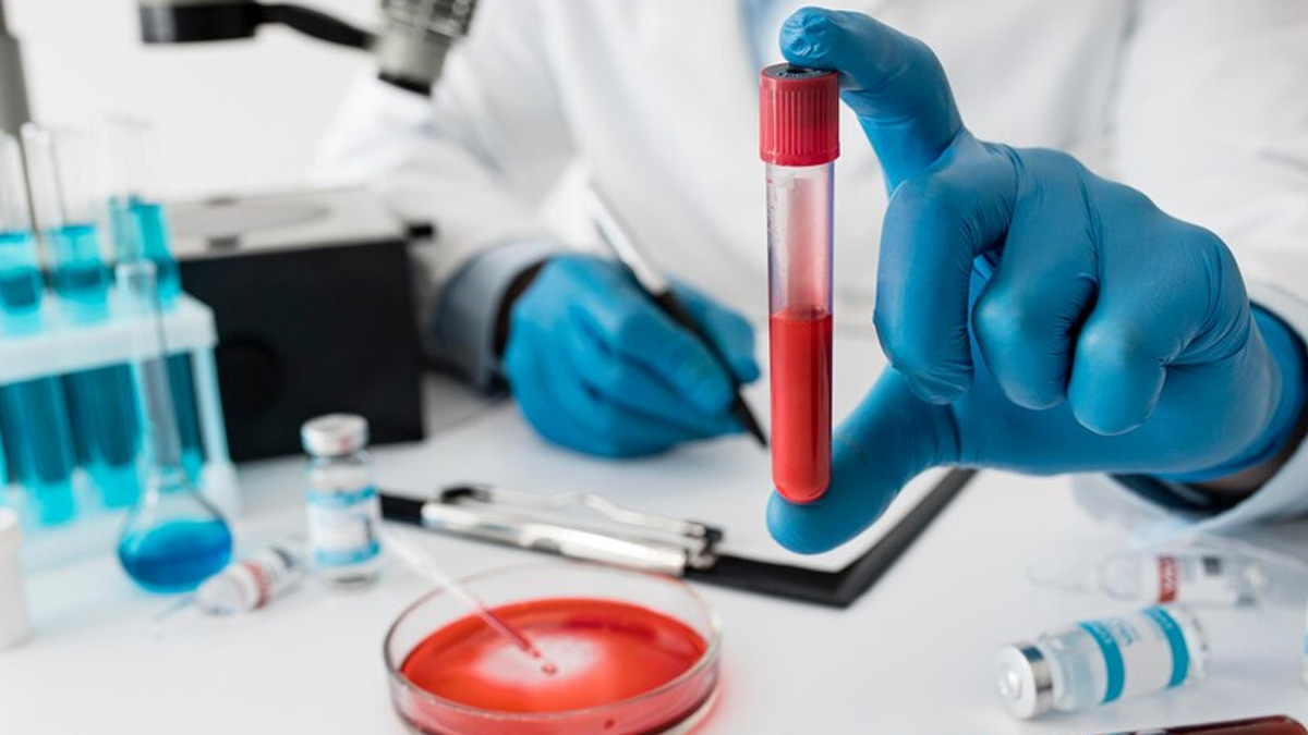 leukocytosis in hindi