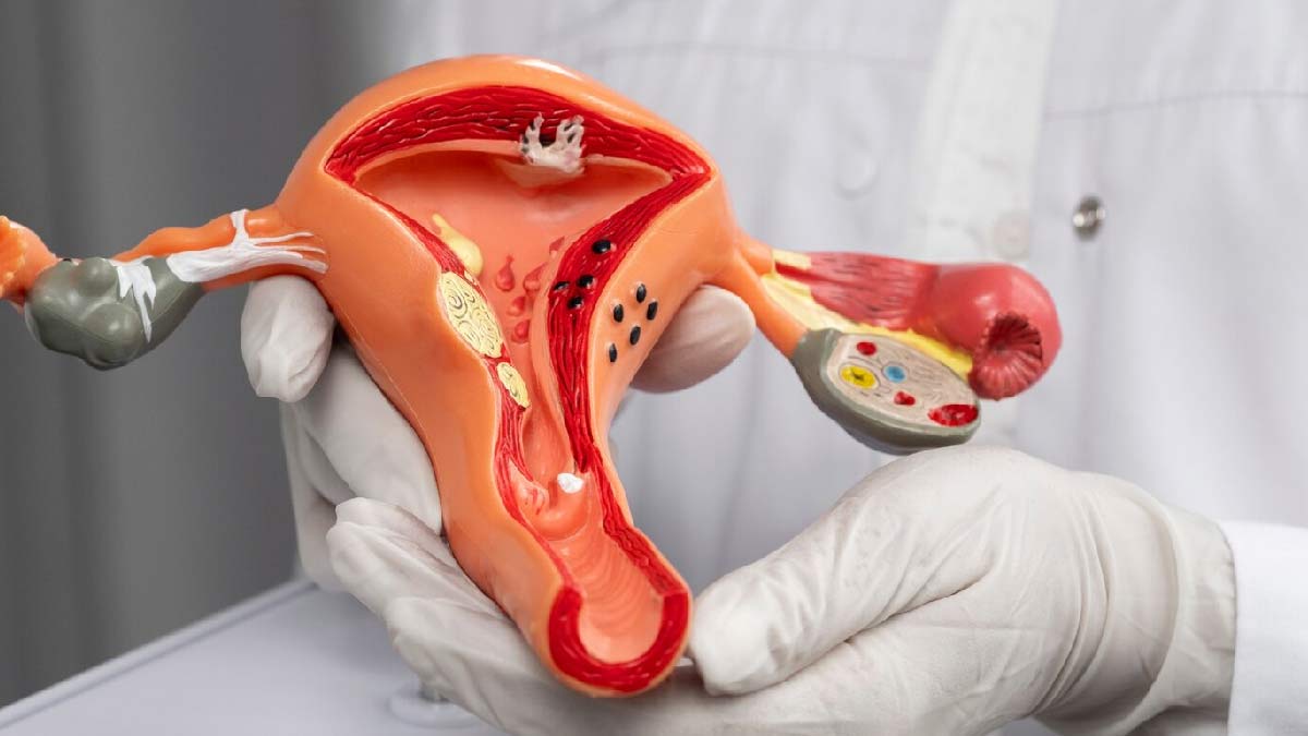 How To Do  Kegel Exercise To Prevent Prolapse Uterus In Hindi